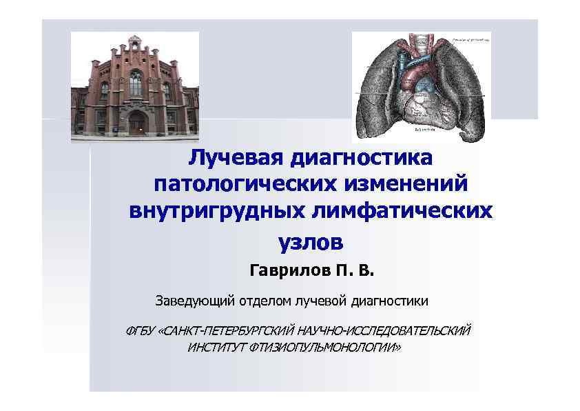 Лучевая диагностика патологических изменений внутригрудных лимфатических узлов Гаврилов П. В. Заведующий отделом лучевой диагностики