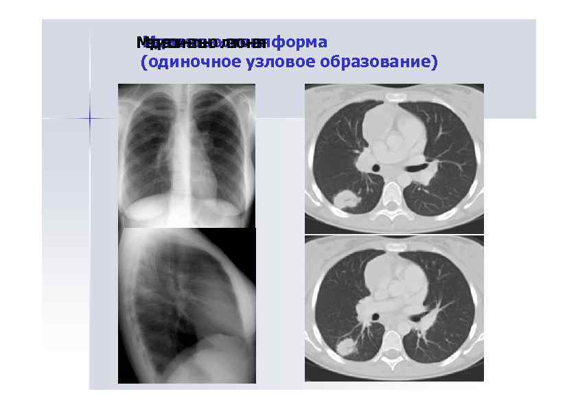 Мд аинл о ле ч а Ме иси аьн-лгоняформа еи стнль о ег ч