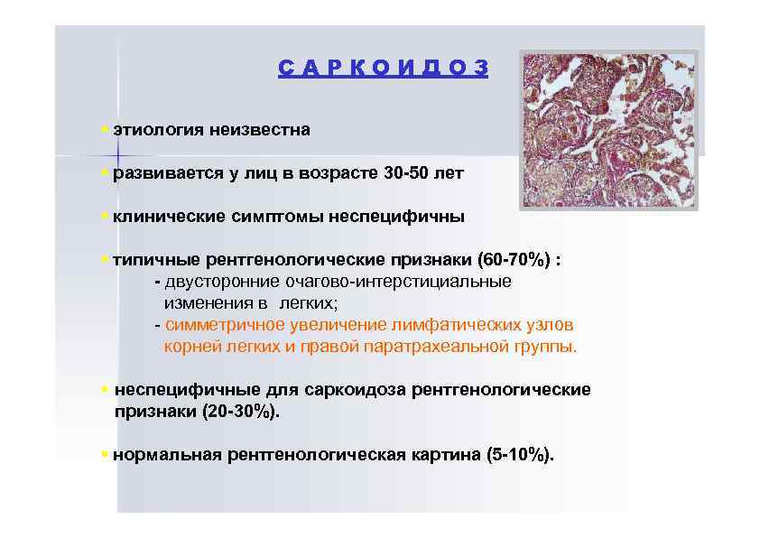 Неизвестного генеза. Саркоидоз этиология патогенез.