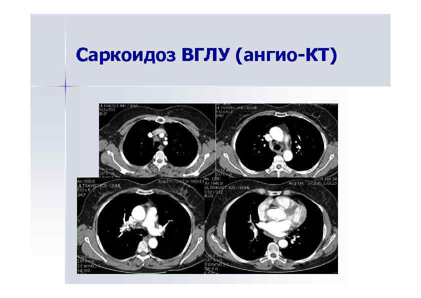 Карта тахограф сызрань