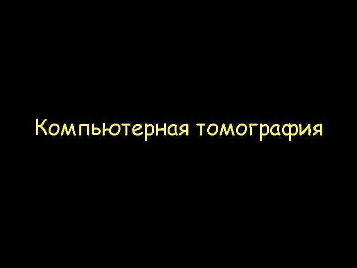 Компьютерная томография 
