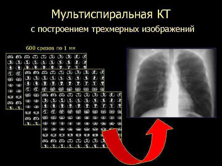 Мультиспиральная КТ с построением трехмерных изображений 600 срезов по 1 мм 