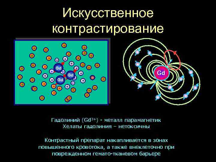Искусственное контрастирование Gd Gd Гадолиний (Gd 3+) - металл парамагнетик Хелаты гадолиния – нетоксичны