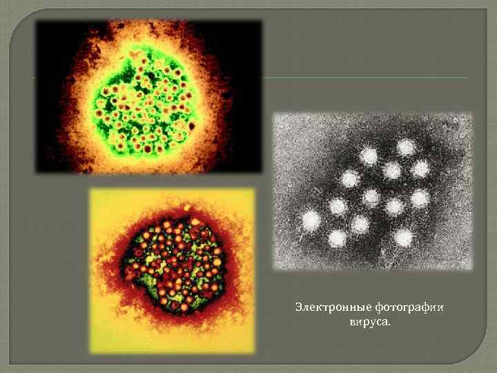 Электронные фотографии вируса. 