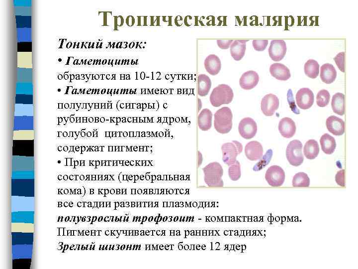 Тропическая малярия Тонкий мазок: • Гаметоциты образуются на 10 -12 сутки; • Гаметоциты имеют