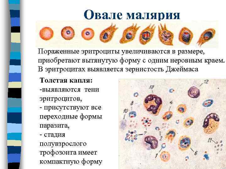 Овале малярия Пораженные эритроциты увеличиваются в размере, приобретают вытянутую форму с одним неровным краем.