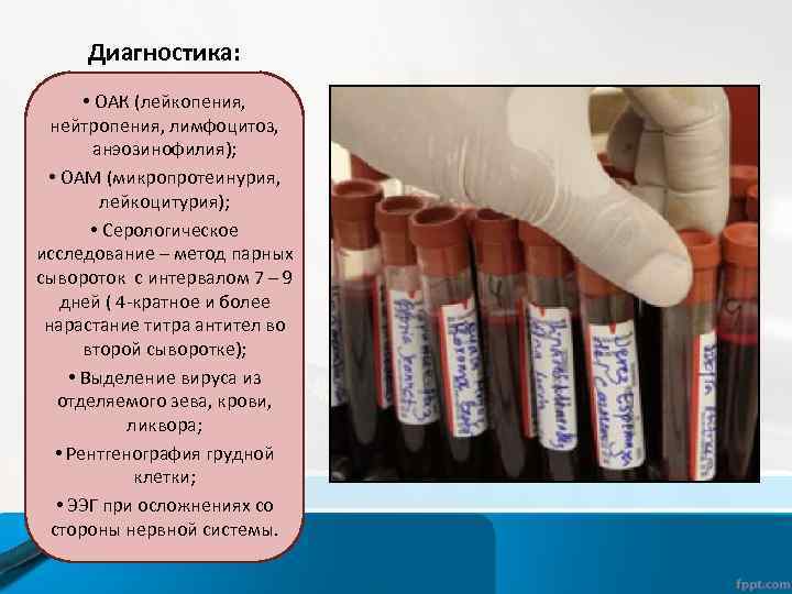 Диагностика: • ОАК (лейкопения, нейтропения, лимфоцитоз, анэозинофилия); • ОАМ (микропротеинурия, лейкоцитурия); • Серологическое исследование