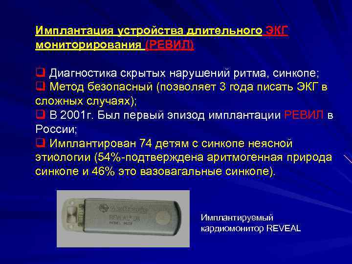 Имплантация устройства длительного ЭКГ мониторирования (РЕВИЛ) q Диагностика скрытых нарушений ритма, синкопе; q Метод
