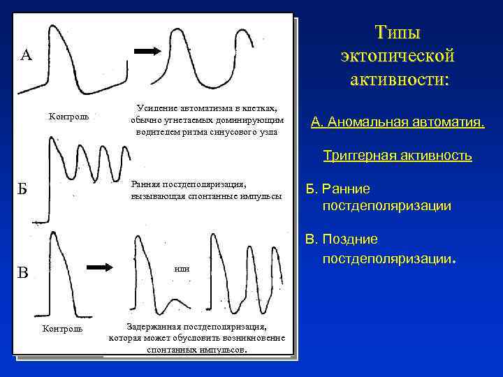 Типы эктопической активности: А Контроль Усиление автоматизма в клетках, обычно угнетаемых доминирующим водителем ритма