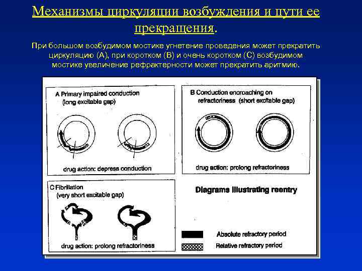 Механизмы циркуляции возбуждения и пути ее прекращения. При большом возбудимом мостике угнетение проведения может