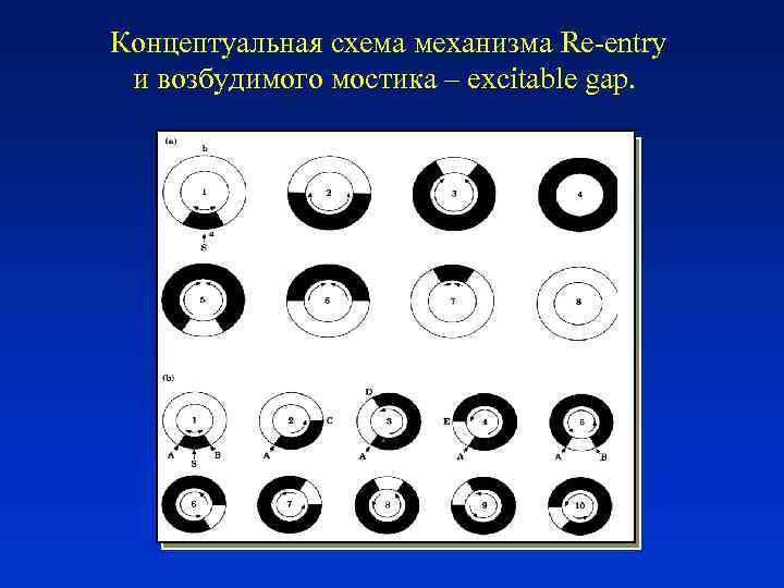 Концептуальная схема механизма Re-entry и возбудимого мостика – excitable gap. 