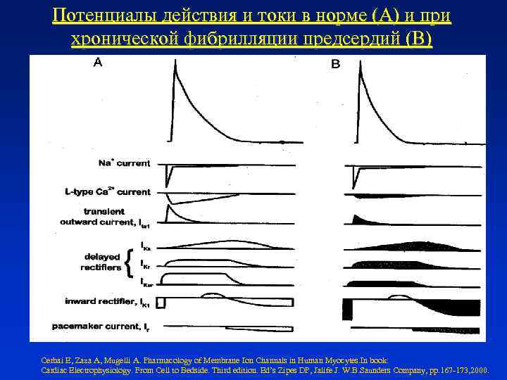 Потенциалы действия и токи в норме (А) и при хронической фибрилляции предсердий (В) Cerbai
