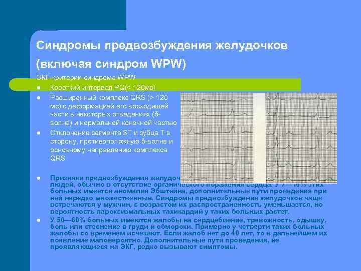 Синдромы предвозбуждения желудочков (включая синдром WPW) ЭКГ критерии синдрома WPW l Короткий интервал PQ(<