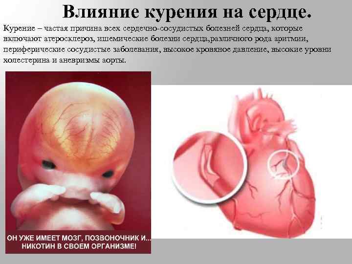 Влияние курения на сердце. Курение – частая причина всех сердечно-сосудистых болезней сердца, которые включают