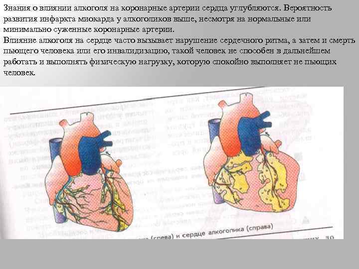 Знания о влиянии алкоголя на коронарные артерии сердца углубляются. Вероятность развития инфаркта миокарда у