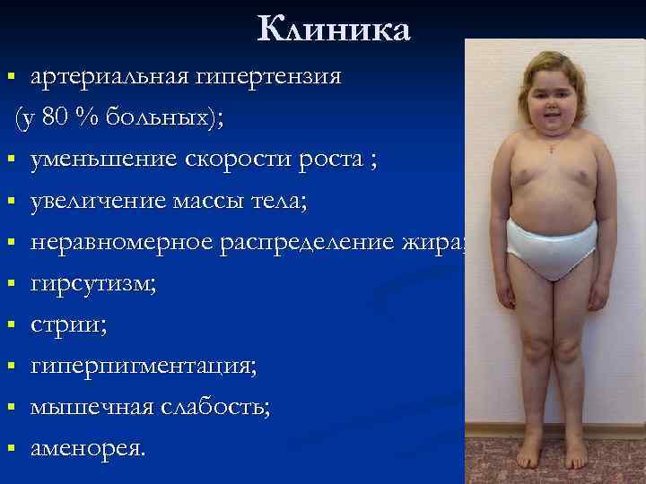 Клиника артериальная гипертензия (у 80 % больных); § уменьшение скорости роста ; § увеличение