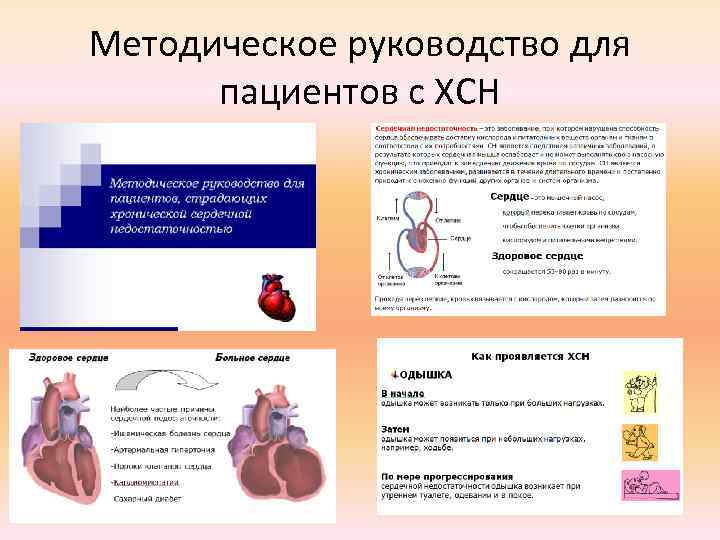 Методическое руководство для пациентов с ХСН 