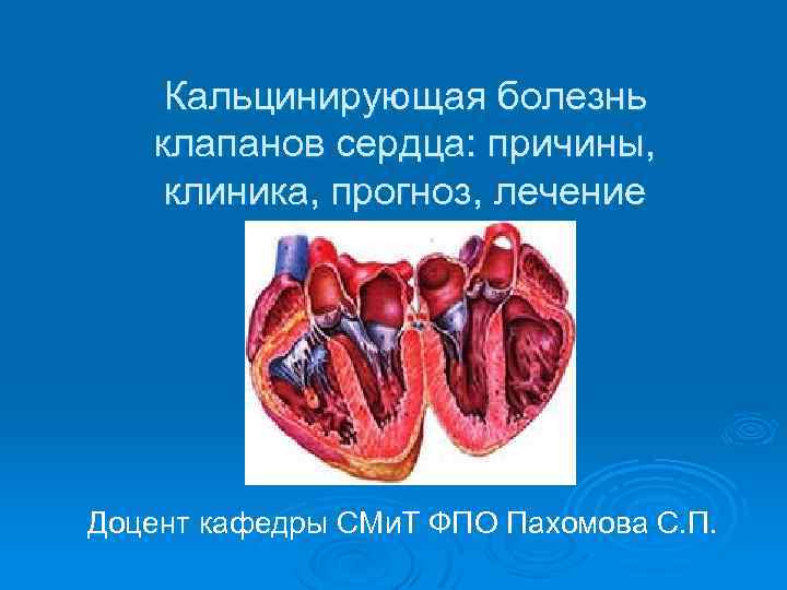 Кальцинирующая болезнь клапанов сердца: причины, клиника, прогноз, лечение Доцент кафедры СМи. Т ФПО Пахомова