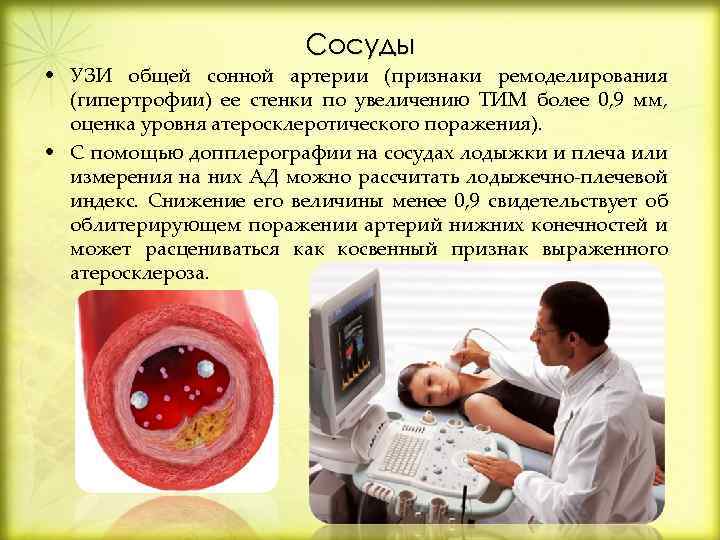 Сосуды • УЗИ общей сонной артерии (признаки ремоделирования (гипертрофии) ее стенки по увеличению ТИМ