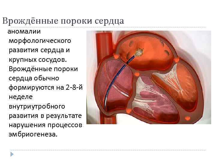 Врождённые пороки сердца аномалии морфологического развития сердца и крупных сосудов. Врождённые пороки сердца обычно