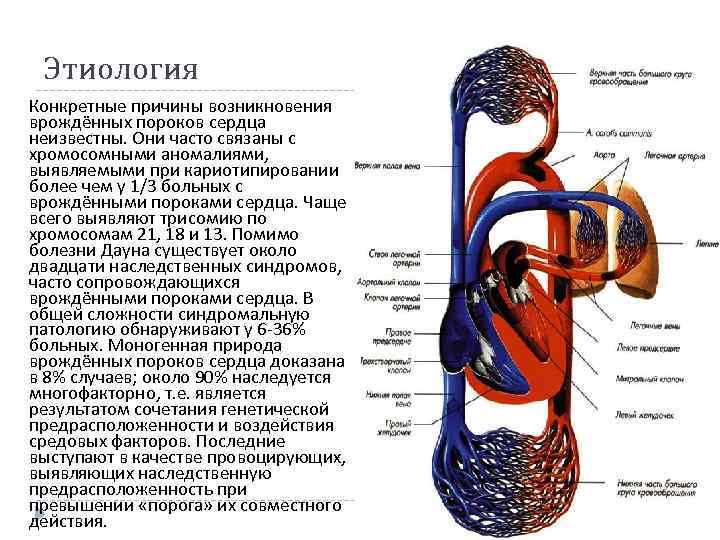 Этиология Конкретные причины возникновения врождённых пороков сердца неизвестны. Они часто связаны с хромосомными аномалиями,