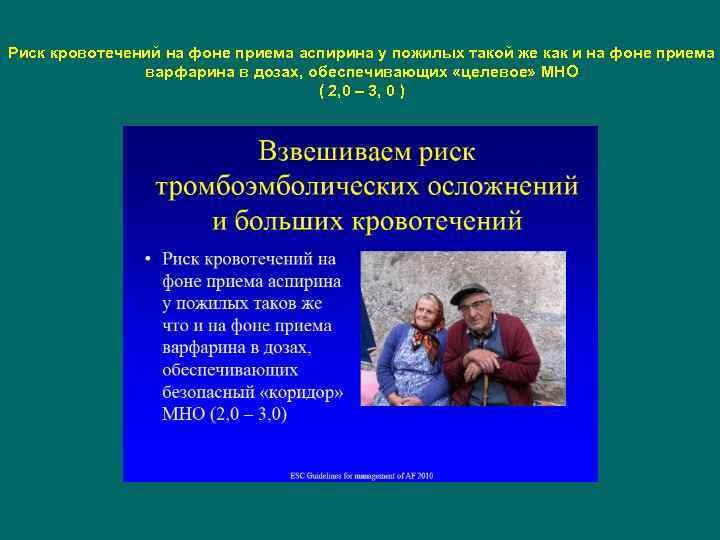 Риск кровотечений на фоне приема аспирина у пожилых такой же как и на фоне