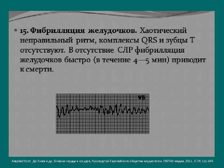 Adapted from: Дж. Кэмм и др. Болезни сердца и сосудов. Руководство Европейского общества кардиологов.