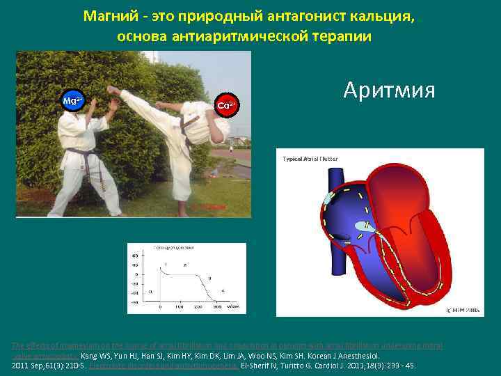 Магний - это природный антагонист кальция, основа антиаритмической терапии Mg 2+ Са 2+ Аритмия