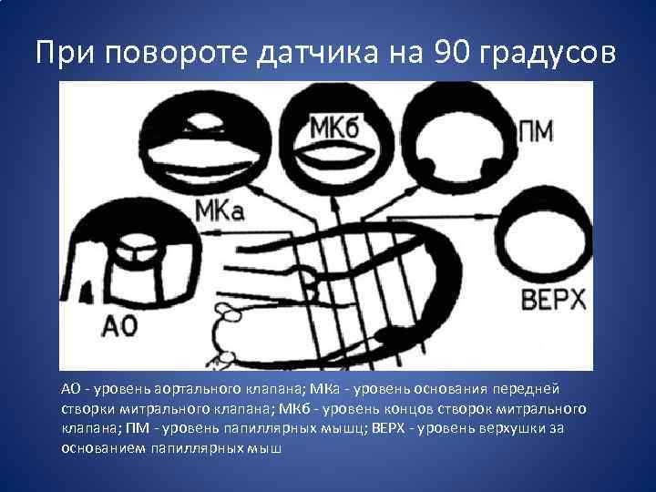 При повороте датчика на 90 градусов АО - уровень аортального клапана; МКа - уровень