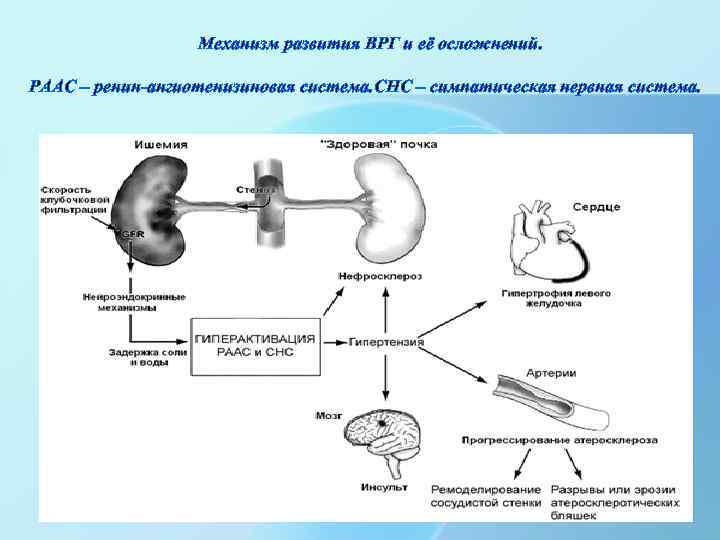 Механизм развития ВРГ и её осложнений. РААС – ренин-ангиотенизиновая система. СНС – симпатическая нервная
