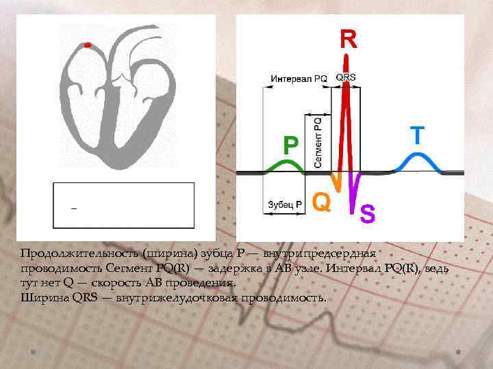 Продолжительность (ширина) зубца Р — внутрипредсердная проводимость Сегмент PQ(R) — задержка в АВ узле.