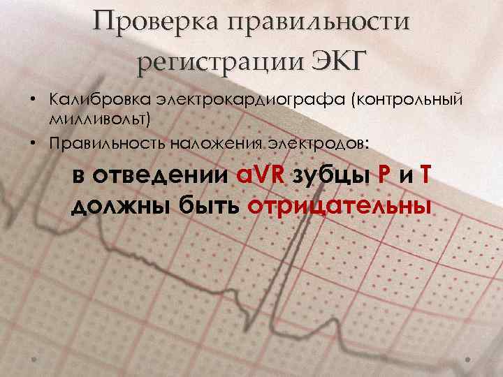 Проверка правильности регистрации ЭКГ • Калибровка электрокардиографа (контрольный милливольт) • Правильность наложения электродов: в