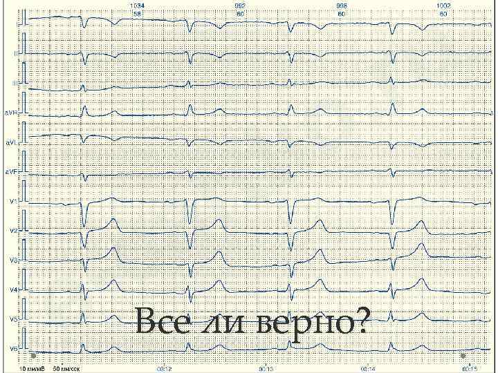 Все ли верно? 