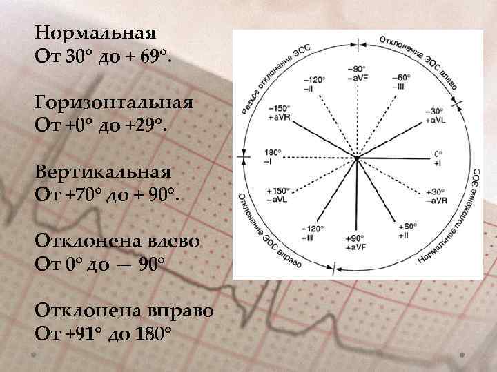 Нормальная От 30○ до + 69○. Горизонтальная От +0○ до +29○. Вертикальная От +70○