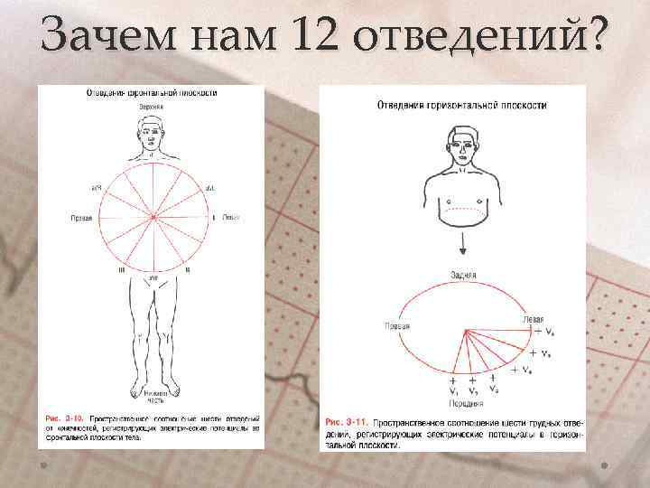 Зачем нам 12 отведений? 