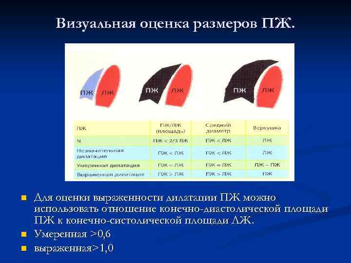 Визуальная оценка размеров ПЖ. n n n Для оценки выраженности дилатации ПЖ можно использовать
