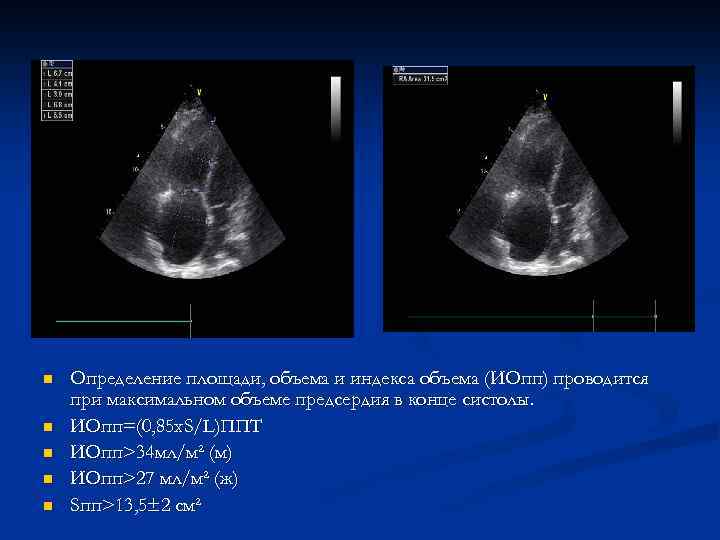 n n n Определение площади, объема и индекса объема (ИОпп) проводится при максимальном объеме