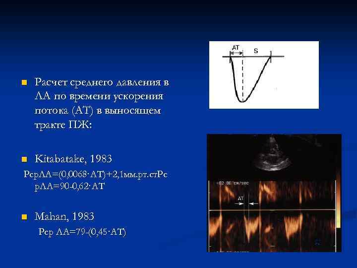 n Расчет среднего давления в ЛА по времени ускорения потока (АТ) в выносящем тракте