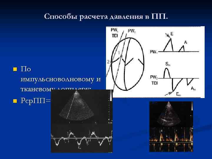 Способы расчета давления в ПП. n n По импульсноволновому и тканевому допплеру: Рср. ПП=1,