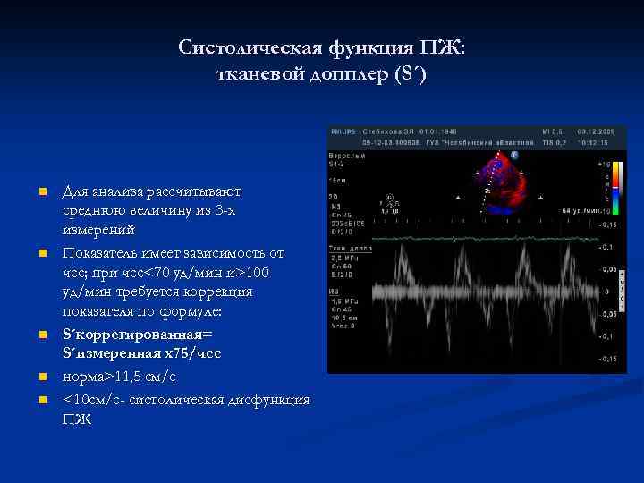 Cистолическая функция ПЖ: тканевой допплер (S´) n n n Для анализа рассчитывают среднюю величину