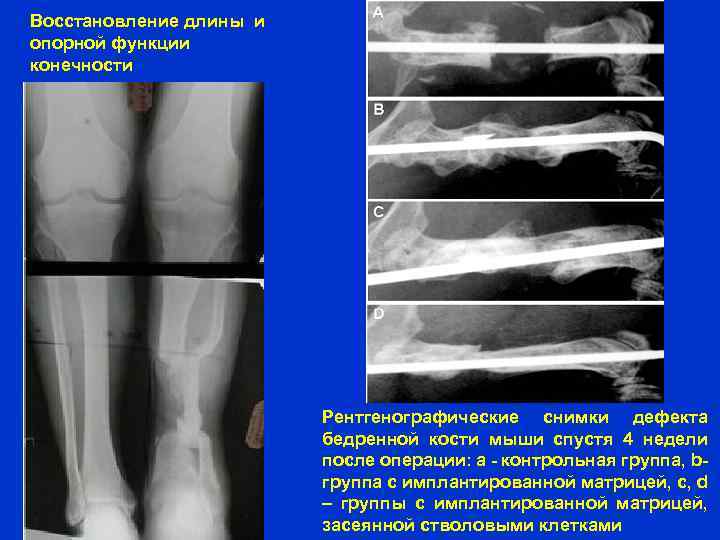 Восстановление длины и опорной функции конечности Рентгенографические снимки дефекта бедренной кости мыши спустя 4