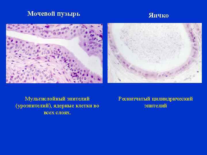 Мочевой пузырь Мультислойный эпителий (уроэпителий), ядерные клетки во всех слоях. Яичко Реснитчатый цилиндрический эпителий