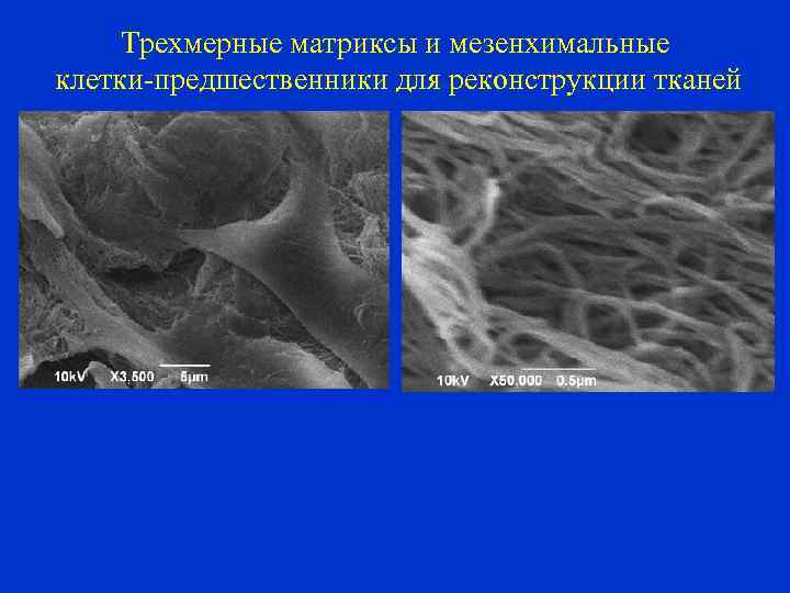 Трехмерные матриксы и мезенхимальные клетки-предшественники для реконструкции тканей 