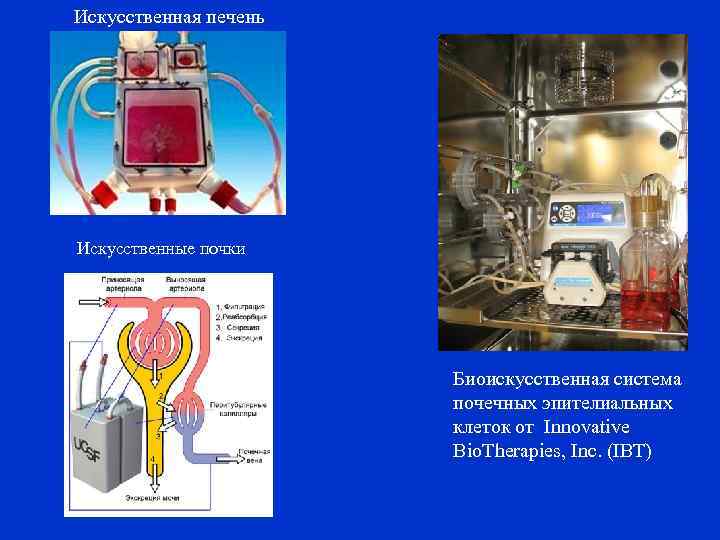 Искусственная печень Искусственные почки Биоискусственная система почечных эпителиальных клеток от Innovative Bio. Therapies, Inc.