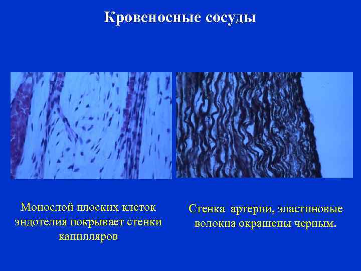 Кровеносные сосуды Монослой плоских клеток эндотелия покрывает стенки капилляров Стенка артерии, эластиновые волокна окрашены