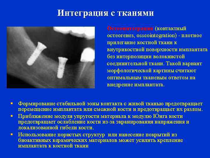 Интеграция с тканями Остеоинтеграция (контактный остеогенез, osseointegration) - плотное прилегание костной ткани к внутрикостной