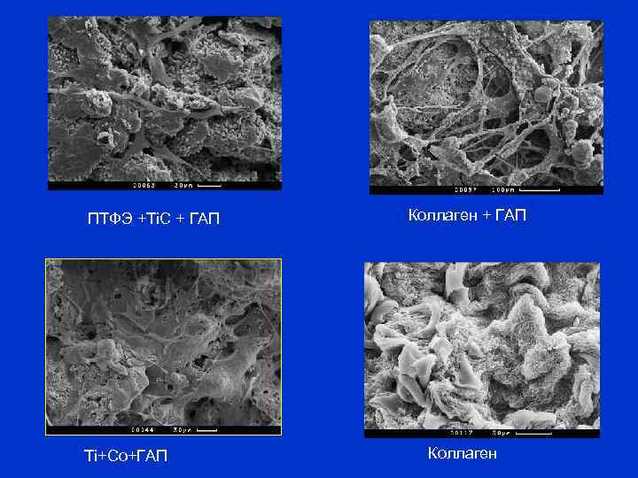 ПТФЭ +Ti. C + ГАП Ti+Co+ГАП Коллаген + ГАП Коллаген 