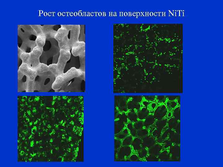 Рост остеобластов на поверхности Ni. Ti 