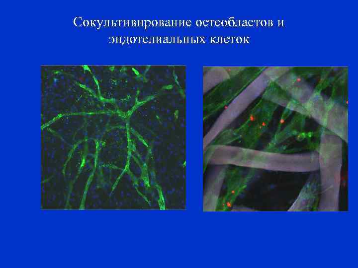 Сокультивирование остеобластов и эндотелиальных клеток 