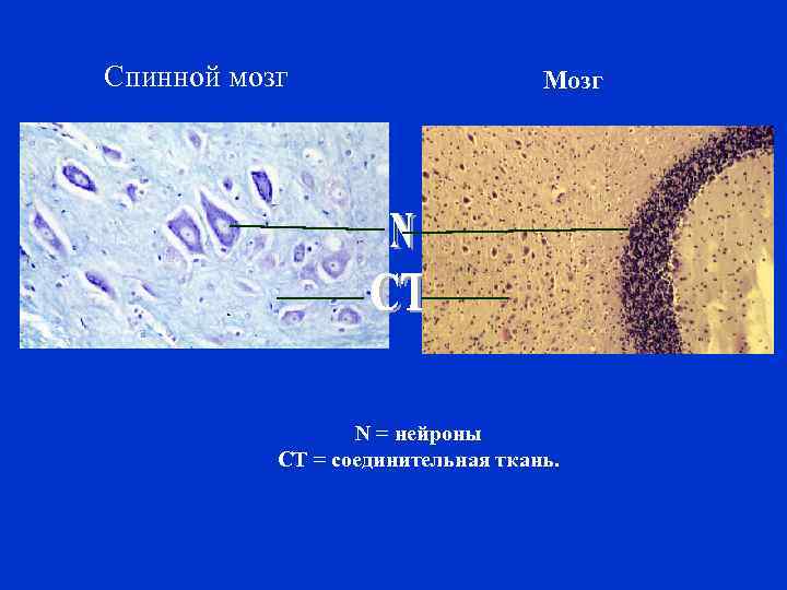 Спинной мозг Мозг N = нейроны CT = соединительная ткань. 